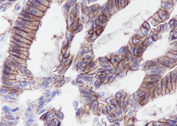 CDH17／LI-cadherin Recombinant Rabbit Monoclonal Antibody