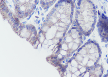 CDH17／LI-cadherin Recombinant Rabbit Monoclonal Antibody