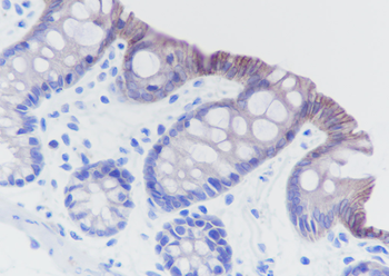 CDH17／LI-cadherin Recombinant Rabbit Monoclonal Antibody