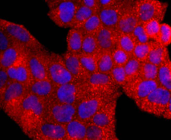 AHR Recombinant Rabbit Monoclonal Antibody