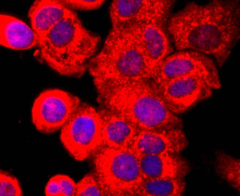 AHR Recombinant Rabbit Monoclonal Antibody