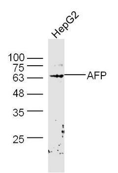 AFP Rabbit Polyclonal Antibody