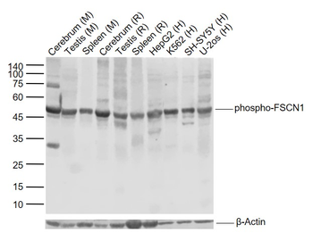 Phospho-FSCN1 (Ser39) Rabbit Polyclonal Antibody