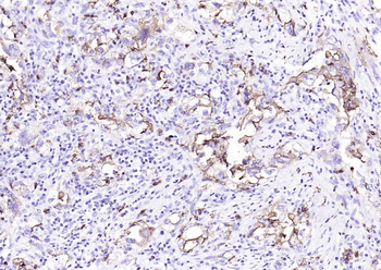 Human CD15 (SSEA-1) Mouse Monoclonal Antibody