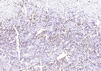 Human CD15 (SSEA-1) Mouse Monoclonal Antibody