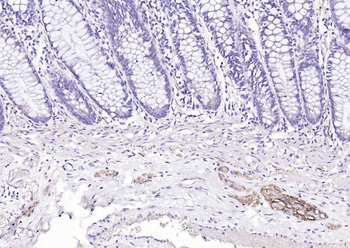 NCAM Recombinant Rabbit Monoclonal Antibody