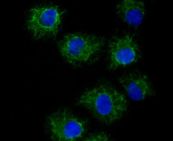 TYRP1 Recombinant Rabbit Monoclonal Antibody