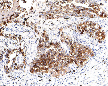 TYRP1 Recombinant Rabbit Monoclonal Antibody