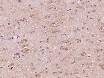 CSEN Rabbit Polyclonal Antibody