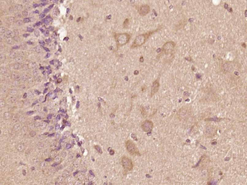 CSEN Rabbit Polyclonal Antibody