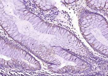 HCN3 Rabbit Polyclonal Antibody