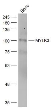 MYLK3 Rabbit Polyclonal Antibody