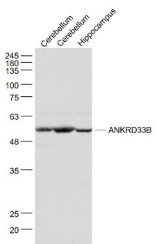 ANKRD33B Rabbit Polyclonal Antibody