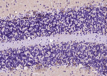 Alpha Synuclein Recombinant Rabbit Monoclonal Antibody
