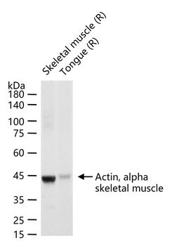 Actin, alpha skeletal muscle Mouse Monoclonal Antibody