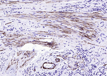 Actin, alpha skeletal muscle Mouse Monoclonal Antibody