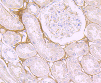 Biglycan Recombinant Rabbit Monoclonal Antibody