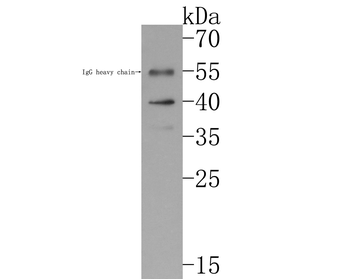 Biglycan Recombinant Rabbit Monoclonal Antibody