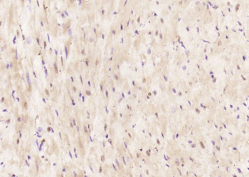 LRRC2 Rabbit Polyclonal Antibody