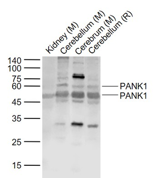 PANK1 Rabbit Polyclonal Antibody