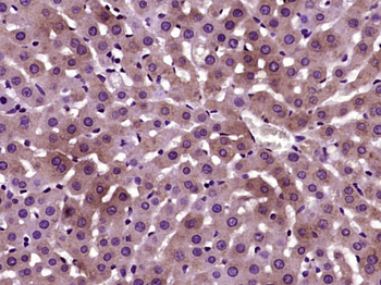 PANK3 Rabbit Polyclonal Antibody