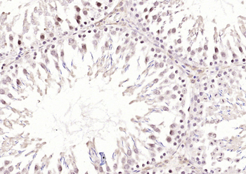 Ube2N Rabbit Polyclonal Antibody