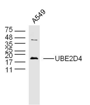 UBE2D4 Rabbit Polyclonal Antibody