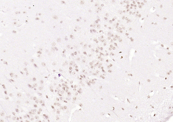 LRRC41 Rabbit Polyclonal Antibody