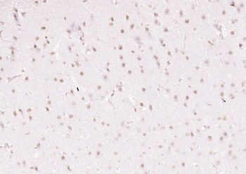 LRRC41 Rabbit Polyclonal Antibody