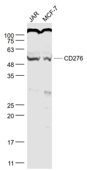 B7-H3/CD276 Rabbit Polyclonal Antibody