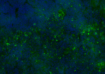 CD8B Rabbit Polyclonal Antibody