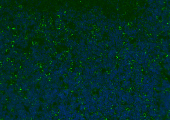 CD8B Rabbit Polyclonal Antibody