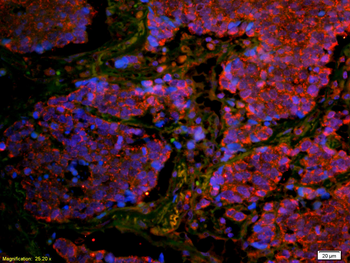 CD8B Rabbit Polyclonal Antibody