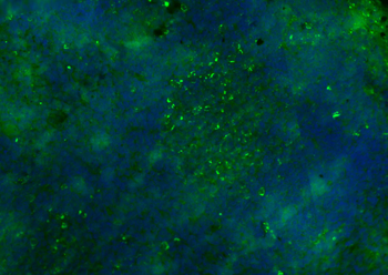 CD8B Rabbit Polyclonal Antibody