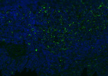 CD8B Rabbit Polyclonal Antibody