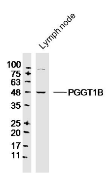 FNTB Rabbit Polyclonal Antibody