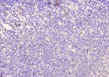 TBX18 Rabbit Polyclonal Antibody