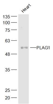 PLAG1 Rabbit Polyclonal Antibody