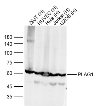PLAG1 Rabbit Polyclonal Antibody