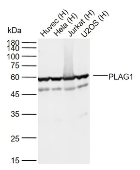PLAG1 Rabbit Polyclonal Antibody
