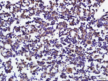 PLAG1 Rabbit Polyclonal Antibody