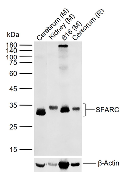 SPARC Rabbit Polyclonal Antibody