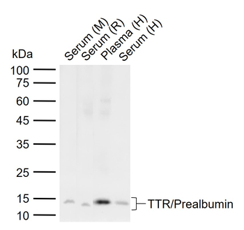 TTR/Prealbumin Rabbit Polyclonal Antibody