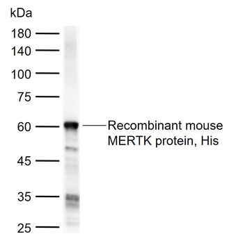 MERTK Rabbit Polyclonal Antibody