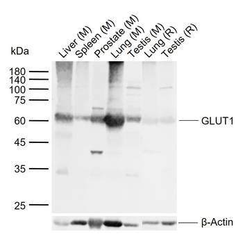 GLUT1 Rabbit Polyclonal Antibody
