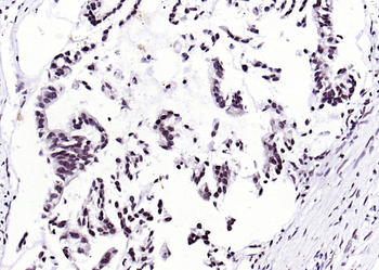 THRB Rabbit Polyclonal Antibody