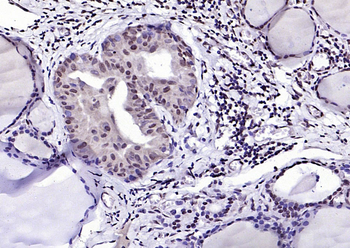 THRB Rabbit Polyclonal Antibody