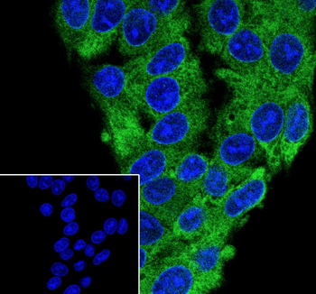 GART Mouse Monoclonal Antibody