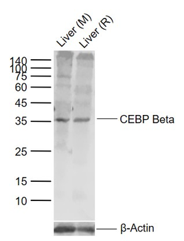CEBP Beta Rabbit Polyclonal Antibody