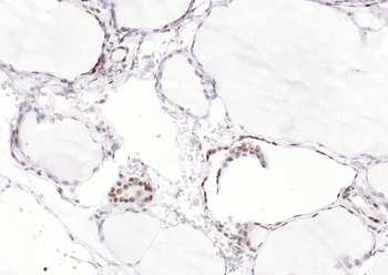 PAX8 Recombinant Rabbit Monoclonal Antibody